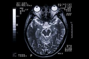小平でインプラント治療を受ける